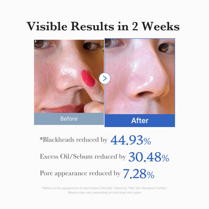Lior's Medicube™ Zero Pore Pad